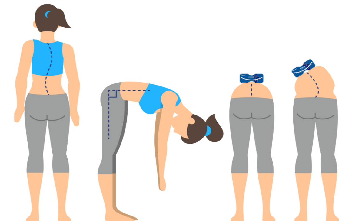 軀干旋轉測量儀檢查